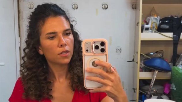 Anica Lazić pokazala nos tri meseca posle operacije i iznenadila fanove – Anica Lazić nos