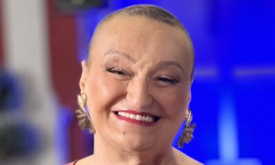 Milica Dugalić otvoreno o borbi sa karcinomom: Ne gubim osmeh ni energiju – karcinom dojke