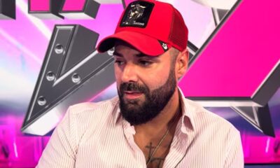 Luka Vujović otkrio planove iz Turske: Vraća se zbog transplantacije kose – transplantacija kose u Turskoj