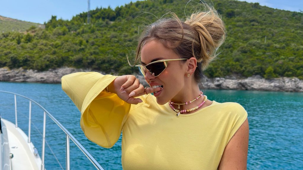 Sofija Šašić otvoreno o operaciji nosa: Iskrena ispovest privukla pažnju fanova – Sofija Šašić operacija nosa