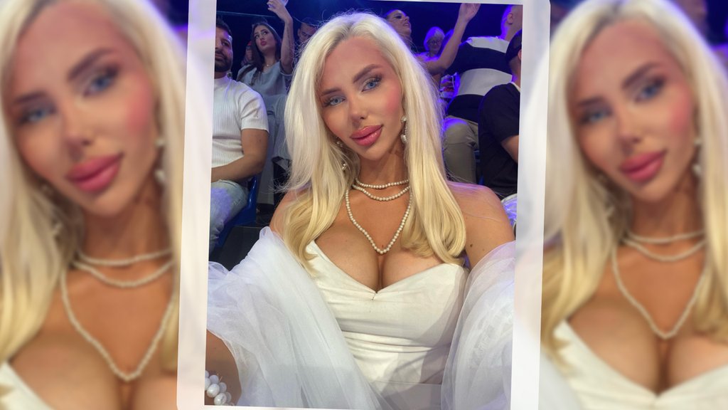 Vanja Prodanović pokazala transformaciju: Fotografije pre estetskih zahvata iznenadile fanove – Vanja Prodanović pre estetskih zahvata