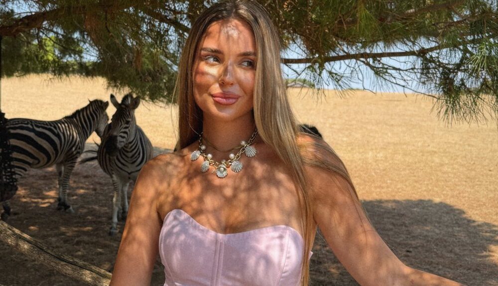 PREOKRET KOD INFLUENSERKE: Lea Stanković javno otkrila zbog čega uklanja hijaluron iz usana, a njena odluka izazvala lavinu komentara (FOTO) – hijaluron u usnama