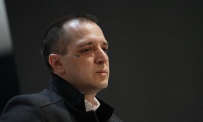 DRAMA NAKON PREBIJANJA ZORANA MARJANOVIĆA: Kompozitor zadržan u bolnici zbog kontuzije mozga, lekari otkrili detalje (FOTO) – napad na Zorana Marjanovića