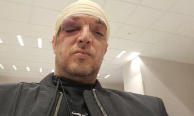 PREOKRET U SLUČAJU ZORANA MARJANOVIĆA: Odbija saradnju sa policijom nakon brutalnog napada, ključni detalji još uvek nepoznati (FOTO) – napad u Beogradu