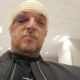 PREOKRET U SLUČAJU ZORANA MARJANOVIĆA: Odbija saradnju sa policijom nakon brutalnog napada, ključni detalji još uvek nepoznati (FOTO) – napad u Beogradu