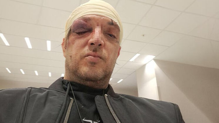 PREOKRET U SLUČAJU ZORANA MARJANOVIĆA: Odbija saradnju sa policijom nakon brutalnog napada, ključni detalji još uvek nepoznati (FOTO) – napad u Beogradu