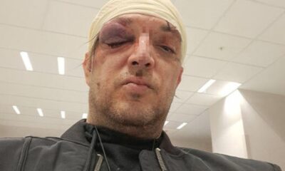 TUČA U STANU NA KARABURMI: Zoran Marjanović pretučen tokom večeri sa društvom, svi bili u alkoholisanom stanju (FOTO) – napad u Beogradu