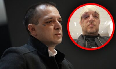 ZORAN MARJANOVIĆ PREKIDA TIŠINU POSLE BRUTALNOG SUKOBA: Odbio da otkrije napadača policiji, javnost u šoku (FOTO) – napad u Beogradu
