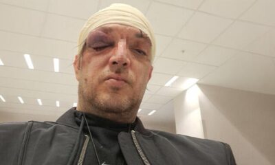 KARAMBOL NA PALILULI: Zoran Marjanović brutalno pretučen, ljubavna drama prerasla u haos, a napadač i dalje nepoznat – napad u Beogradu