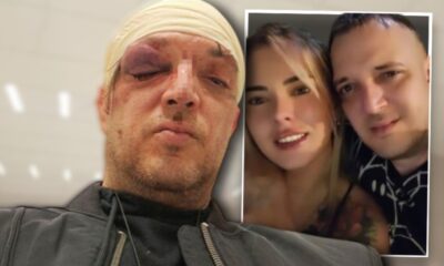 BRUTALAN OBRAČUN NA PALILULI: Zoran Marjanović pretučen zbog rijaliti devojke, istraga još traje (FOTO) – napad u Beogradu