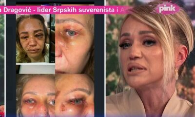 PRITVOR ZA NASILNIKA KOJI JE ŠOKIRAO JAVNOST: Kristina Kika Živković progovorila o višegodišnjem nasilju, evo šta se sada dešava (FOTO) – napad na Kristinu Kiku Živković