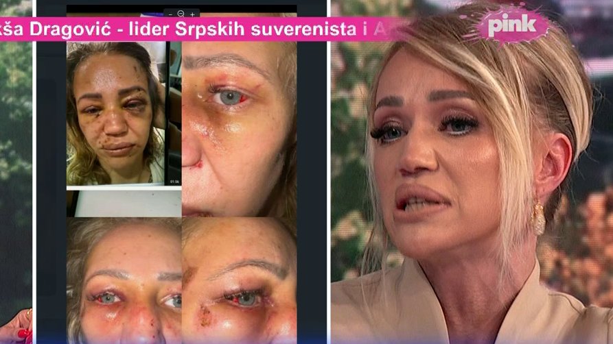 PRITVOR ZA NASILNIKA KOJI JE ŠOKIRAO JAVNOST: Kristina Kika Živković progovorila o višegodišnjem nasilju, evo šta se sada dešava (FOTO) – napad na Kristinu Kiku Živković