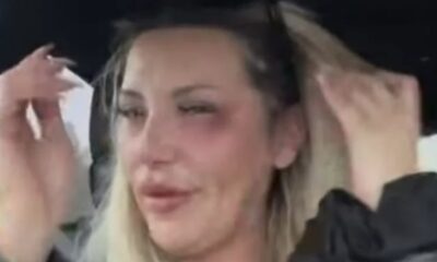 BRUTALNI INCIDENT U DIJASPORI: Pevačica Monika Ivkić otkazala nastup zbog posledica napada, fanovi zabrinuti za njeno zdravlje (FOTO) – napad u dijaspori