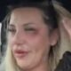 BRUTALNI INCIDENT U DIJASPORI: Pevačica Monika Ivkić otkazala nastup zbog posledica napada, fanovi zabrinuti za njeno zdravlje (FOTO) – napad u dijaspori