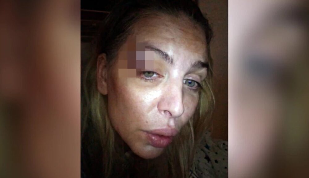 PONOVO U CENTRU PAŽNJE: Ava Karabatić završila u bolnici posle incidenta sa bivšim partnerom, zabrinuti pratioci čekaju rasplet (FOTO) – incident sa Avom Karabatić