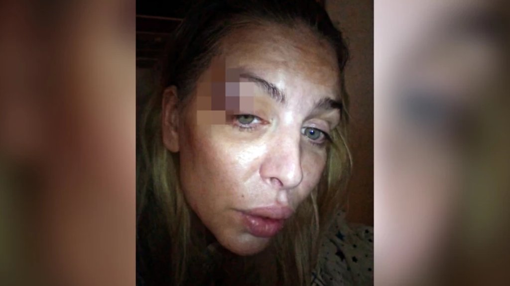 PONOVO U CENTRU PAŽNJE: Ava Karabatić završila u bolnici posle incidenta sa bivšim partnerom, zabrinuti pratioci čekaju rasplet (FOTO) – incident sa Avom Karabatić