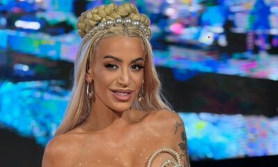 POVREDE KOJE SU ZABRINULE JAVNOST: Dušica Jakovljević objavila slike sa posledicama pada niz stepenice, fanovi u šoku (FOTO) – povrede Dušice Jakovljević
