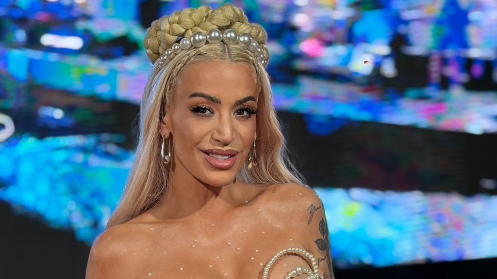 POVREDE KOJE SU ZABRINULE JAVNOST: Dušica Jakovljević objavila slike sa posledicama pada niz stepenice, fanovi u šoku (FOTO) – povrede Dušice Jakovljević