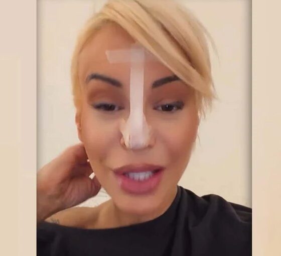 PAO VRH NOSA, SADA NOVA METODA: Dušica Jakovljević otkrila kako rešava problem i iznenadila pratioce (FOTO) – Dušica Jakovljević nos