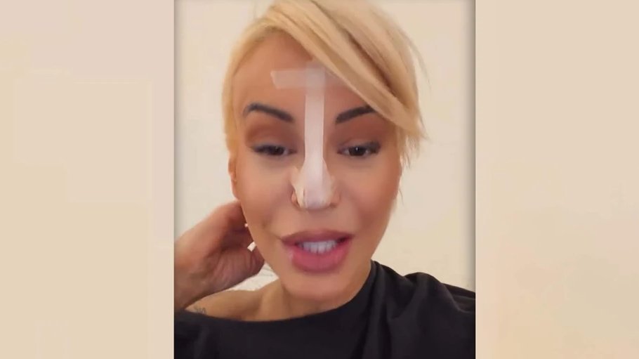PAO VRH NOSA, SADA NOVA METODA: Dušica Jakovljević otkrila kako rešava problem i iznenadila pratioce (FOTO) – Dušica Jakovljević nos